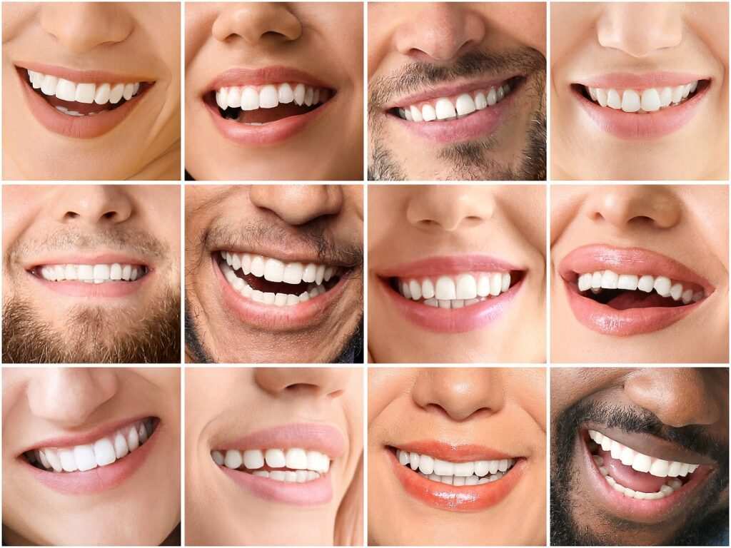 Unlock Your Perfect Smile: A Guide to Smile Design Turkey