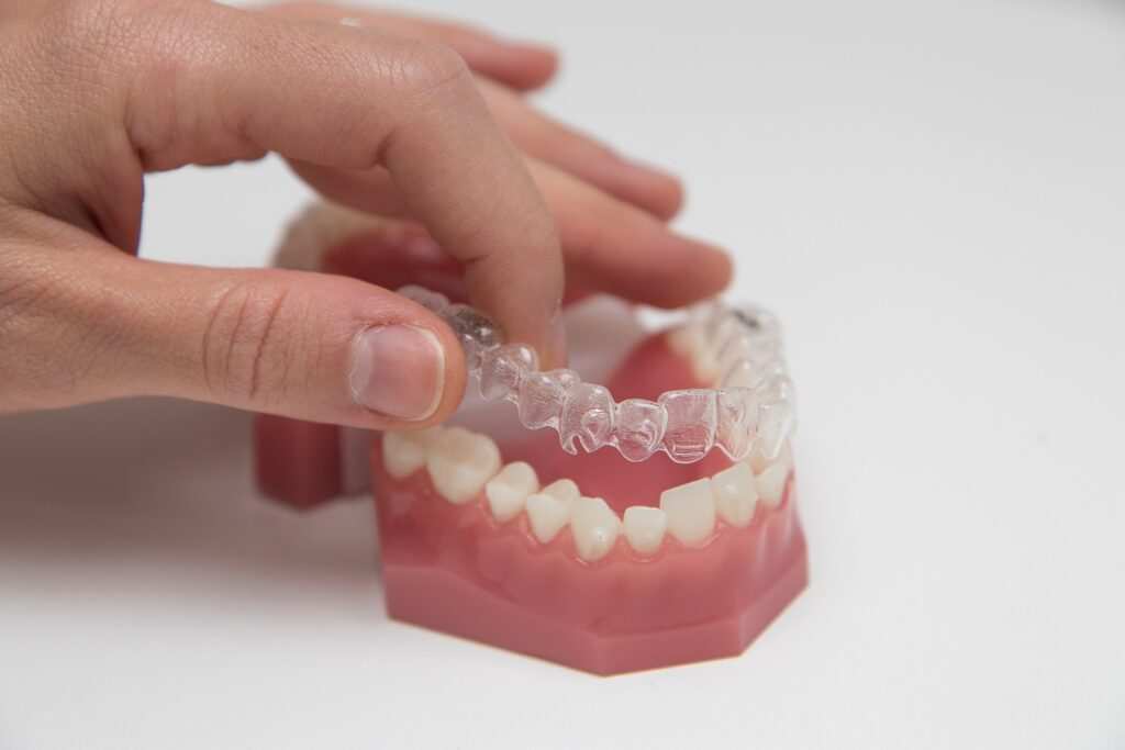 Invisalign: Straightening with Style