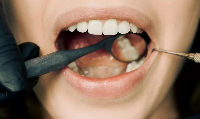 Oral diagnoz, olası ağız ve diş sorunlarını erken aşamada tespit etmeye yarar.