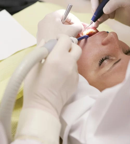 All on Four implantın diğer adı dörtlü implanttır.
