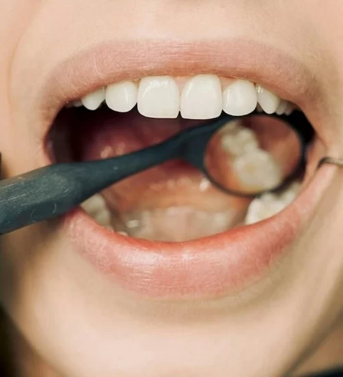 Oral diagnoz, olası ağız ve diş sorunlarını erken aşamada tespit etmeye yarar.